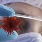 【文獻精度】蛋白組+三代全長轉(zhuǎn)錄組致力于腫瘤標志物的研究