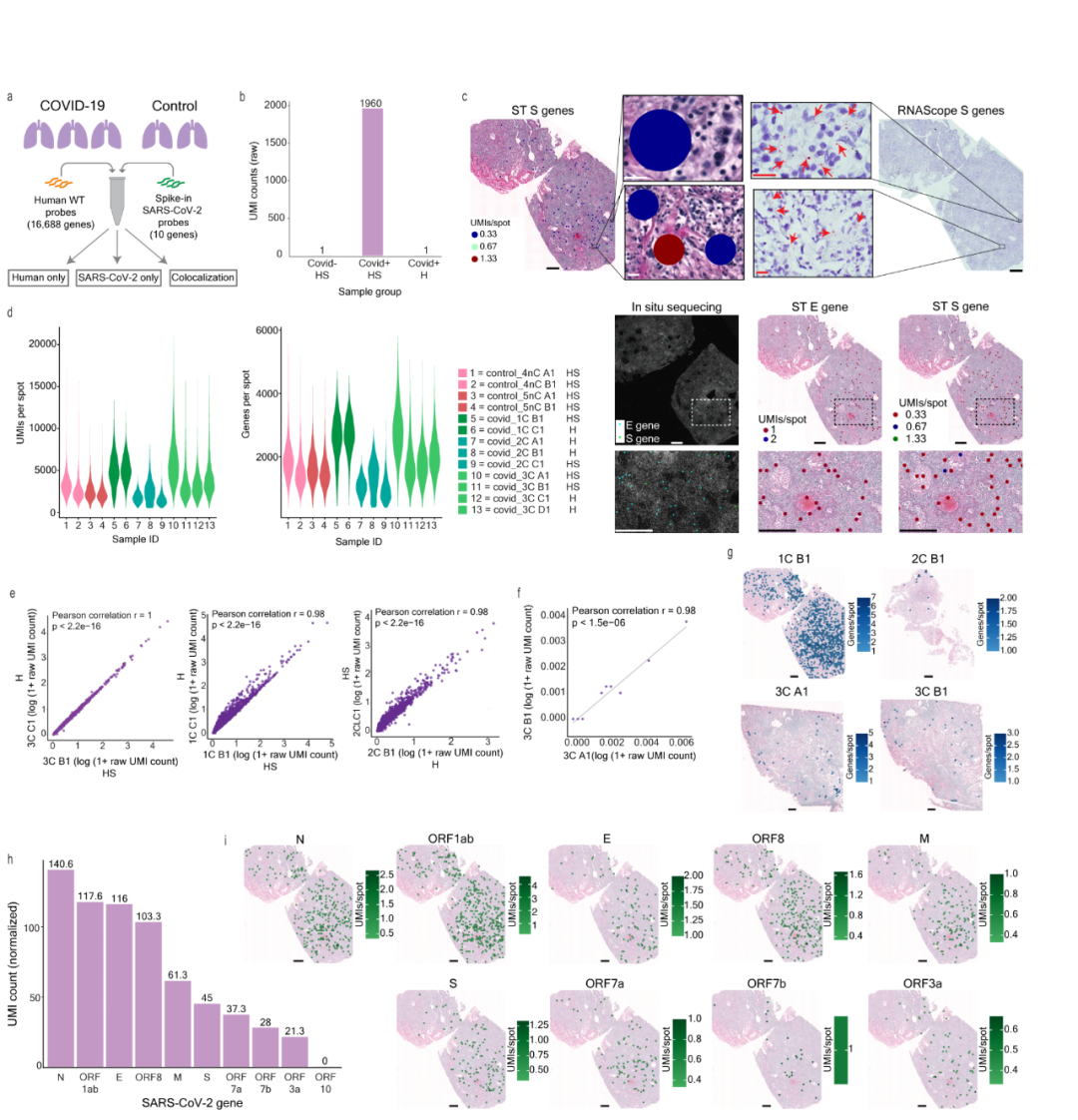 FFPE空間轉(zhuǎn)錄組解析人肺感染SARS-CoV-2 空間共定位新機(jī)制[2]